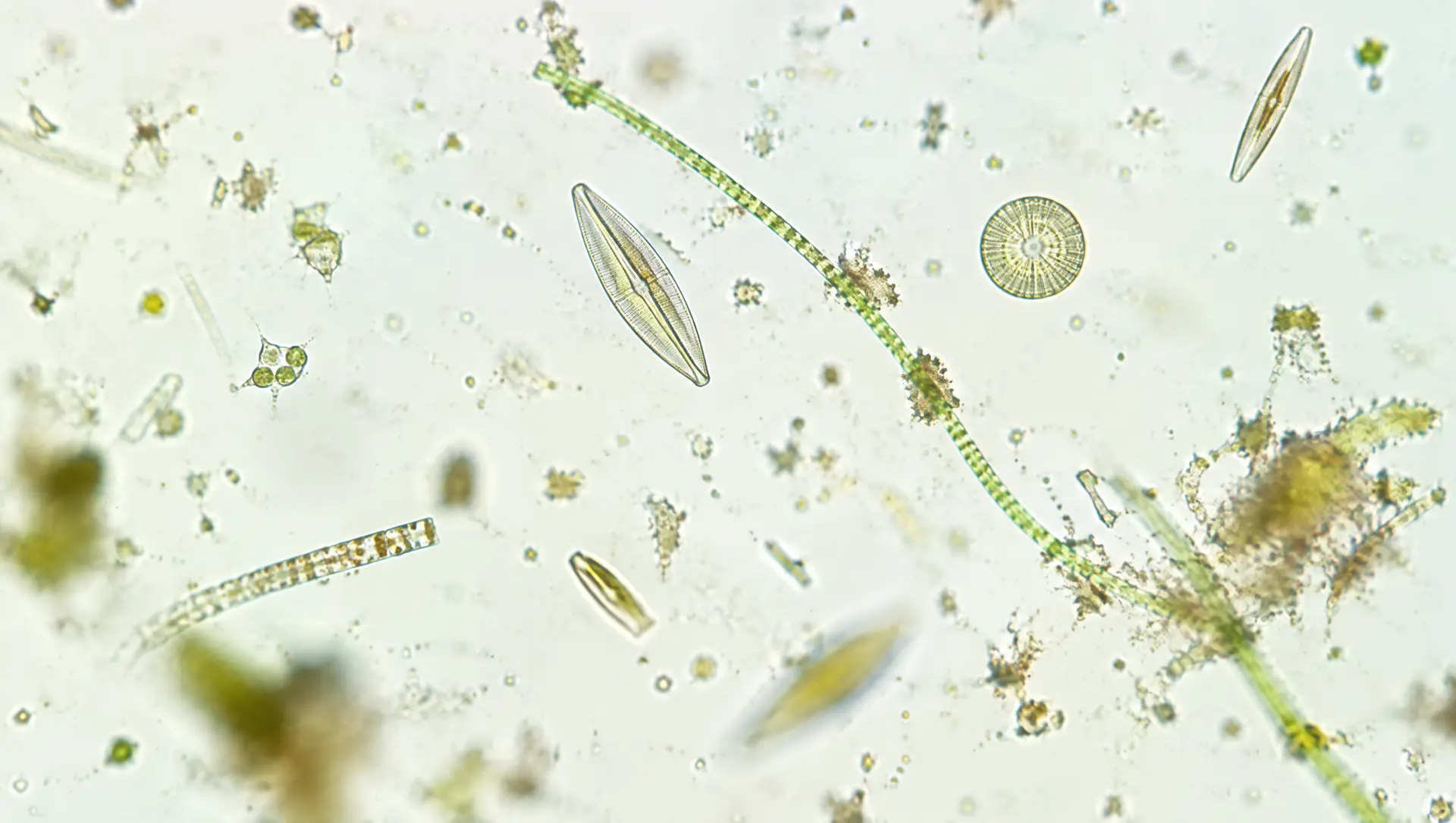 Pond water under a microscope: diatoms, algae threads and drifting specks.